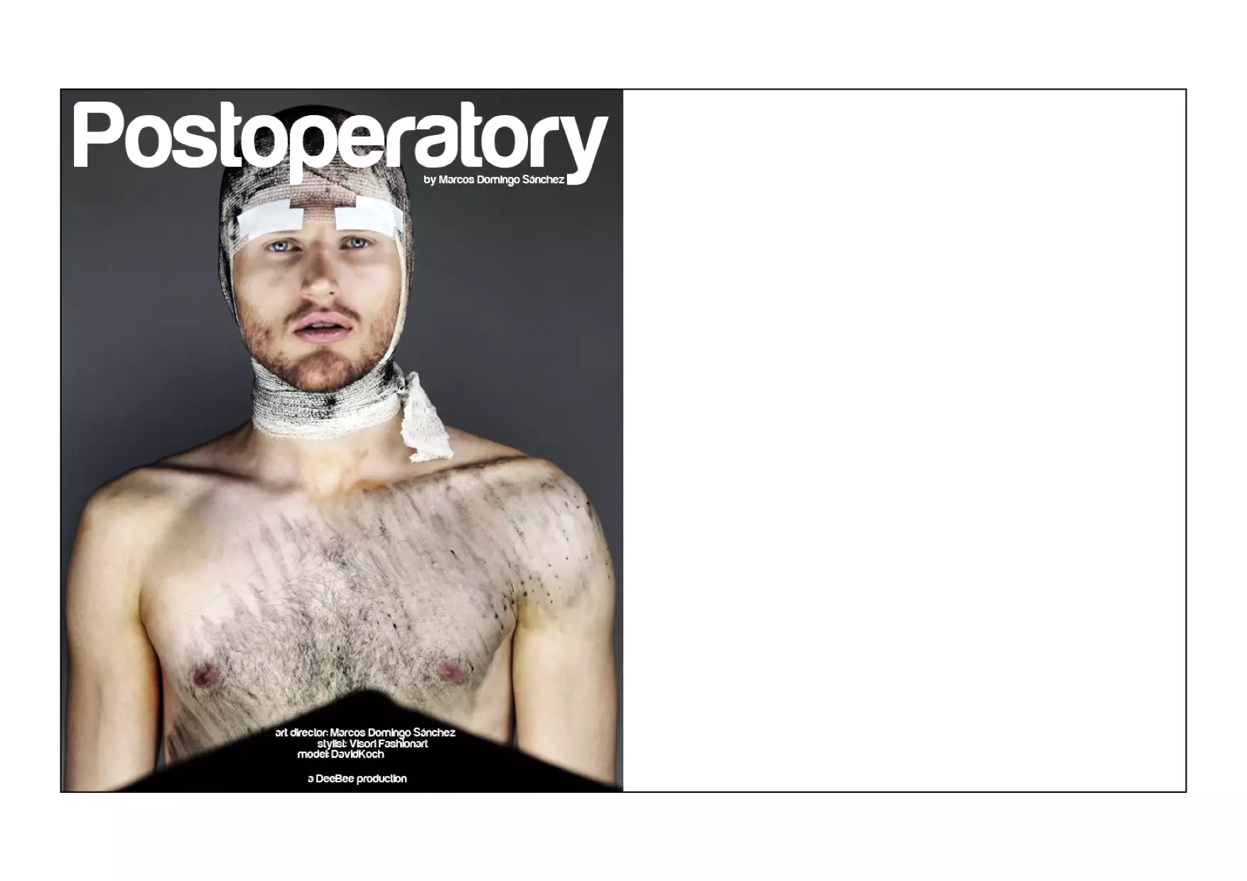 01 POSTOPERATORY