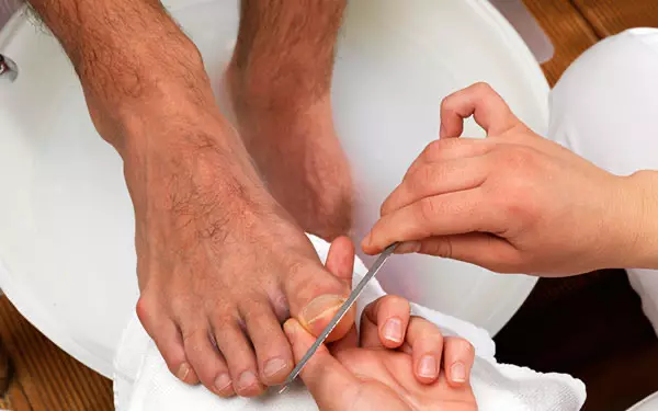 ڪيئن علاج ڪرڻ ۽ مردار Toenail کي روڪڻ لاء